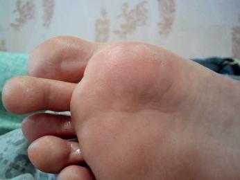 ReversoContex — Bongacams stream photo (Feb 2026)