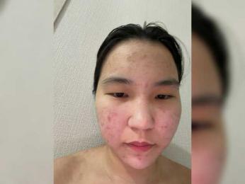 BabyYanSok — modelo de webcam en línea en bongacams